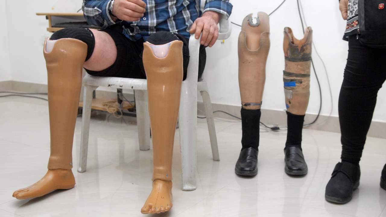 You are currently viewing कणकवली रोटरीच्या वतीने दिव्यांगांचे जयपूर कृत्रिम हात, पाय साठी मोजमाप