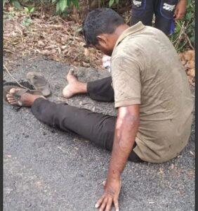 Read more about the article माकड आडवा आल्याने अपघात होऊन दुचाकीस्वार जखमी