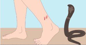 Read more about the article सर्पदंश रुग्णांच्या प्रमाणात वाढ सावंतवाडी उपजिल्हा रुग्णालयामध्ये रुग्णांवर यशस्वी उपचार -रवी जाधव.