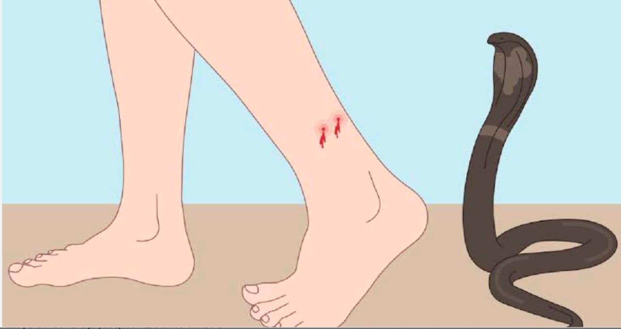 You are currently viewing सर्पदंश रुग्णांच्या प्रमाणात वाढ सावंतवाडी उपजिल्हा रुग्णालयामध्ये रुग्णांवर यशस्वी उपचार -रवी जाधव.