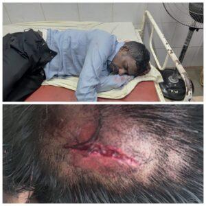 Read more about the article भाईसाहेब समाधी जवळ पुन्हा गवरेड्याने दोघांना उडवलं….