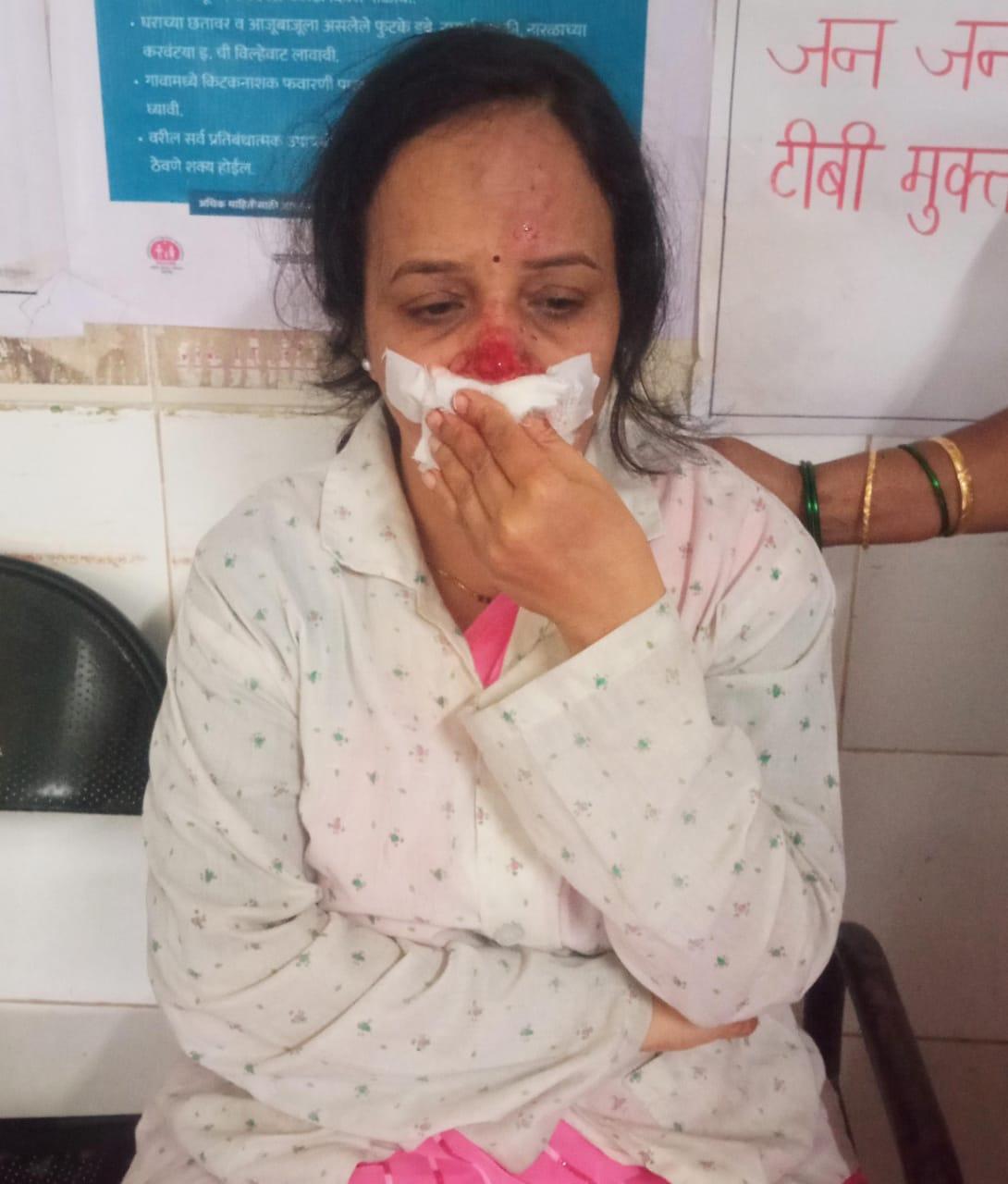 You are currently viewing गव्या रेड्याच्या धडकेने प्राथमिक शिक्षिका सृष्टी पेडणेकर जखमी