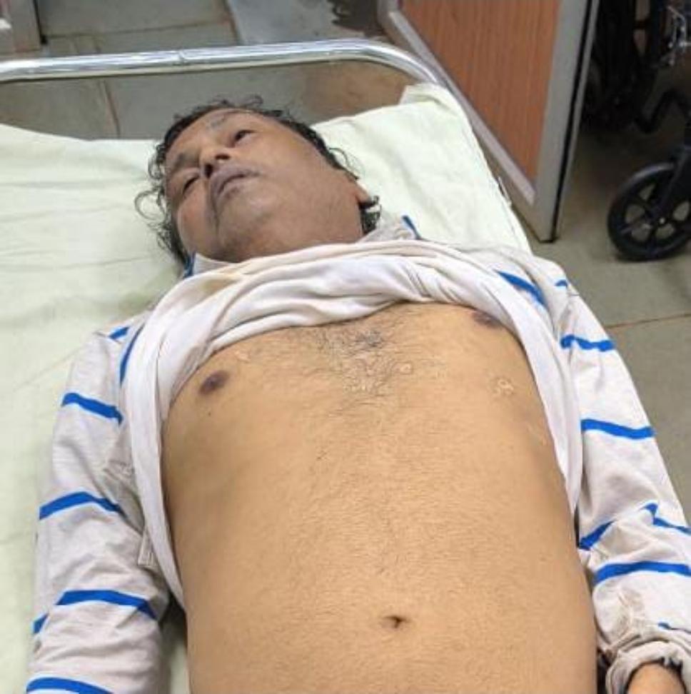 You are currently viewing बस प्रवासात इसमाचा मृत्यू