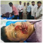 मळगाव मेटा येथे माकड आडवे आल्याने दुचाकी अपघात