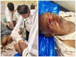 बुर्डीपुल येथे रिक्षा-आयशरची समोरासमोर धडक; दोन जखमी
